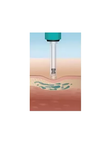 DERMOTECHNIKA-HYALURON PEN