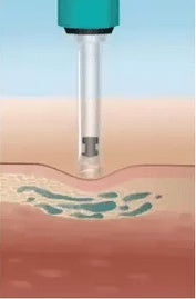 DERMOTECHNIKA - HYALURON PEN - dermes store